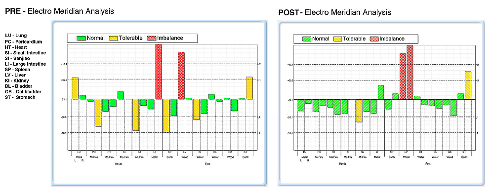 05-Pre-Post-Emas2