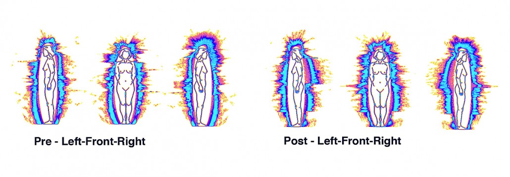 08-Pre-Post-Auras-LFR