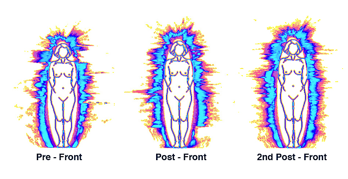 11-Pre-Post-2nd-Aura-Fronts1